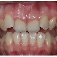 Пример работы до и после - 