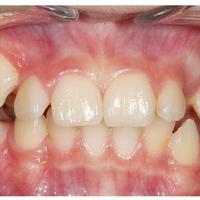 Пример работы до и после - 