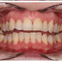 Пример работы до и после - 