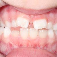 Пример работы до и после - 