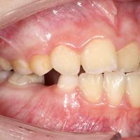 Пример работы до и после - 