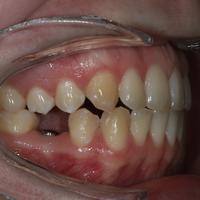 Пример работы до и после - 