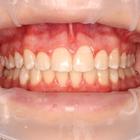 Пример работы до и после - 