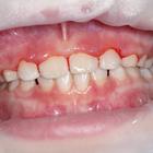 Пример работы до и после - 