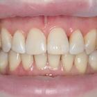 Пример работы до и после - 