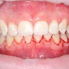 Пример работы до и после - 