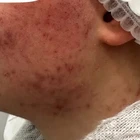 Пример работы до и после - 