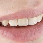 Пример работы до и после - 