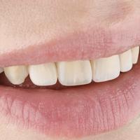 Пример работы до и после - 