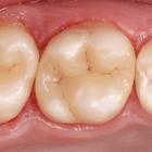 Пример работы до и после - 