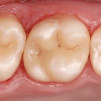 Пример работы до и после - 