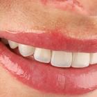 Пример работы до и после - 