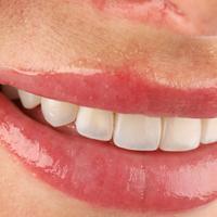 Пример работы до и после - 