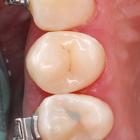 Пример работы до и после - 