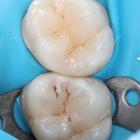 Пример работы до и после - 