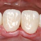 Пример работы до и после - 