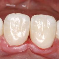 Пример работы до и после - 