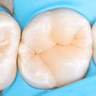 Пример работы до и после - 