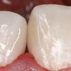 Пример работы до и после - 