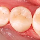 Пример работы до и после - 