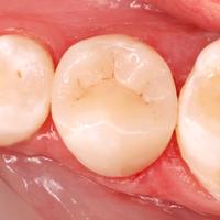 Пример работы до и после - 