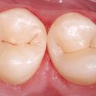 Пример работы до и после - 