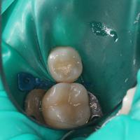 Пример работы до и после - 