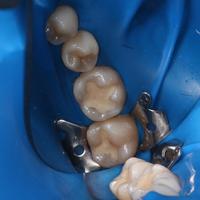 Пример работы до и после - 