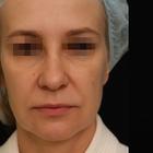 Пример работы до и после - 