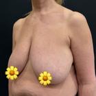 Пример работы до и после - 