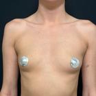 Пример работы до и после - 