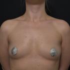 Пример работы до и после - 