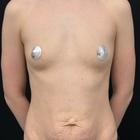 Пример работы до и после - 