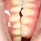 Пример работы до и после - 