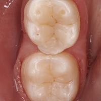 Пример работы до и после -