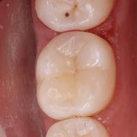 Пример работы до и после -