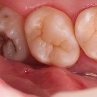 Пример работы до и после -