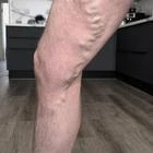 Пример работы до и после - 