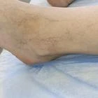 Пример работы до и после - 