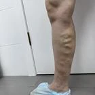 Пример работы до и после - 