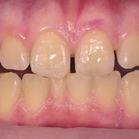 Пример работы до и после -