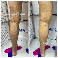 Пример работы до и после - 