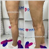 Пример работы до и после - 