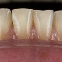 Пример работы до и после -