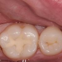 Пример работы до и после -