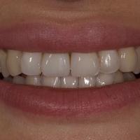 Пример работы до и после -