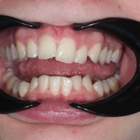 Пример работы до и после -