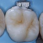 Пример работы до и после - 