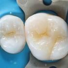 Пример работы до и после - 