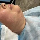 Пример работы до и после - 